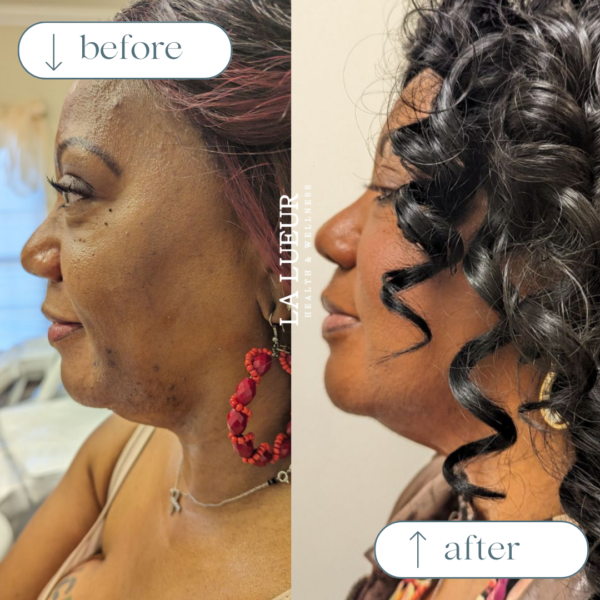 Beige White Minimalist Beauty Skincare Before After Collage Instagram Post (1)