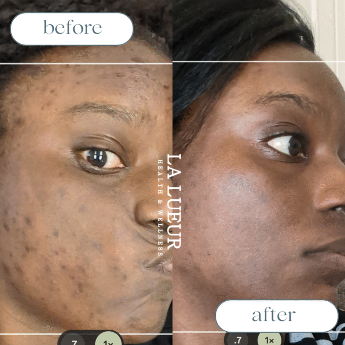 Copy of Beige White Minimalist Beauty Skincare Before After Collage Instagram Post